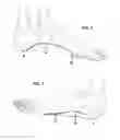 Fig. 04 - Orthopedic shoe appliance