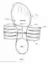 Fig. 04 - Suspension bridging shoe