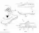 Fig. 07 - Suspension bridging shoe