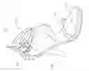 Fig. 07 - High heel shoe
