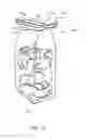 Fig. 17 - Luggage with dynamic volume receptacle