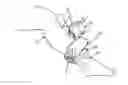Fig. 01 - Assistance system for fitting a medical compression device onto a limb of a patient