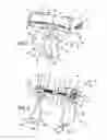 Fig. 02 - Assistance system for fitting a medical compression device onto a limb of a patient