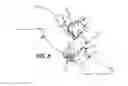 Fig. 05 - Assistance system for fitting a medical compression device onto a limb of a patient