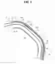 Fig. 06 - ENDOSCOPE BENDING PORTION AND ENDOSCOPE