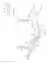 Fig. 03 - Assessing fallopian tubal patency