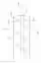 Fig. 08 - BIOPSY DEVICES, SYSTEMS, AND METHODS FOR USE