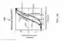 Fig. 03 - Quantification of inter-ocular suppression in binocular vision impairment