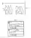 Fig. 03 - METHODS AND APPARATUS FOR LOCATING THE FOSSA OVALIS
