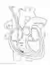 Fig. 01 - Catheters, systems, and related methods for mapping, minimizing, and treating cardiac fibrillation