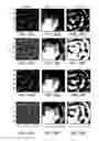 Fig. 41 - Catheters, systems, and related methods for mapping, minimizing, and treating cardiac fibrillation