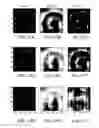 Fig. 43 - Catheters, systems, and related methods for mapping, minimizing, and treating cardiac fibrillation