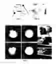 Fig. 03 - Imaging compatible electrode-set for measurement of body electrical signals and methods for fabricating the same using ink-jet printing