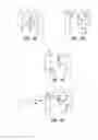 Fig. 06 - Apparatus and method for catheter navigation using endovascular energy mapping