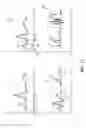 Fig. 17 - Apparatus and method for catheter navigation using endovascular energy mapping