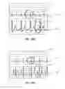 Fig. 19 - Apparatus and method for catheter navigation using endovascular energy mapping