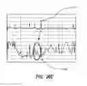 Fig. 24 - Apparatus and method for catheter navigation using endovascular energy mapping