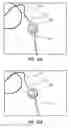Fig. 27 - Apparatus and method for catheter navigation using endovascular energy mapping