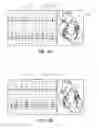 Fig. 31 - Apparatus and method for catheter navigation using endovascular energy mapping