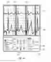 Fig. 41 - Apparatus and method for catheter navigation using endovascular energy mapping