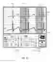 Fig. 42 - Apparatus and method for catheter navigation using endovascular energy mapping