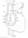 Fig. 46 - Apparatus and method for catheter navigation using endovascular energy mapping