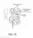 Fig. 09 - Method and apparatus for registration, verification and referencing of internal organs