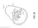 Fig. 13 - Apparatuses and methods for extracting chemicals from bodily cavities and breath