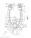 Fig. 07 - Catheter connection and stabilization device and methods of using same