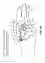 Fig. 22 - Catheter connection and stabilization device and methods of using same