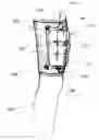 Fig. 01 - Urinary collection system and procedure for decreasing catheter-associated bacteriuria