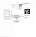Fig. 03 - MRI-guided intraarterial catheter-based method for predicting territory of local blood brain barrier opening
