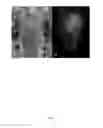 Fig. 04 - MRI-guided intraarterial catheter-based method for predicting territory of local blood brain barrier opening