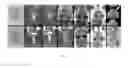 Fig. 06 - MRI-guided intraarterial catheter-based method for predicting territory of local blood brain barrier opening