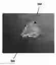 Fig. 01 - CARDIAC CATHETER EMPLOYING CONFORMAL ELECTRONICS FOR MAPPING