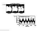 Fig. 14 - CARDIAC CATHETER EMPLOYING CONFORMAL ELECTRONICS FOR MAPPING