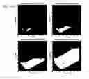 Fig. 16 - CARDIAC CATHETER EMPLOYING CONFORMAL ELECTRONICS FOR MAPPING