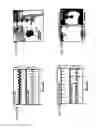 Fig. 28 - CARDIAC CATHETER EMPLOYING CONFORMAL ELECTRONICS FOR MAPPING
