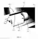 Fig. 05 - Spatial registration of positron emission tomography and computed tomography acquired during respiration