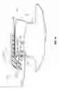 Fig. 41 - System for placement of a catheter including a signal-generating stylet