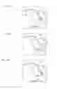 Fig. 06 - DIAGNOSTIC IMAGING CATHETER