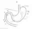 Fig. 08 - Endoscope puncture needle and biopsy system