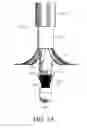 Fig. 14 - DIVERTICULUM INVERSION USING A CLIP PLACEMENT DEVICE