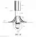 Fig. 19 - DIVERTICULUM INVERSION USING A CLIP PLACEMENT DEVICE