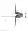 Fig. 33 - DEVICE AND METHODS OF INVERTING A DIVERTICULUM