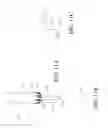 Fig. 47 - DEVICE AND METHODS OF INVERTING A DIVERTICULUM