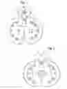 Fig. 02 - Devices and methods for securing surgical guide wires