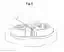 Fig. 06 - Devices and methods for securing surgical guide wires