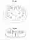Fig. 07 - Devices and methods for securing surgical guide wires