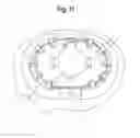 Fig. 09 - Devices and methods for securing surgical guide wires